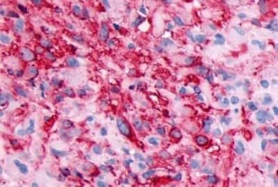 Immunohistochemistry: GPR133 Antibody [NBP3-14348]